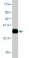 RAB27A Antibody (monoclonal) (M02)